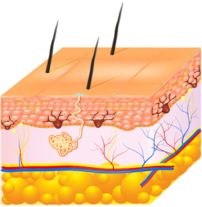 The Epidermis layer of skin