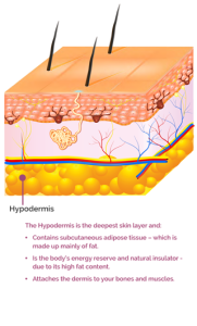 The Hyperdermis skin later text mobile version