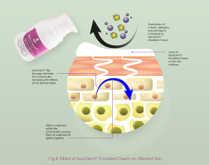 Effect of AproDerm Emollient Cream of affected skin