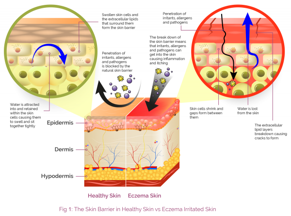 fig1 | AproDerm