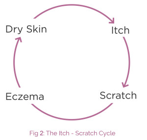 the itch scratch cycle figure 2
