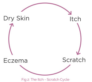 The Itch Scratch Cycle