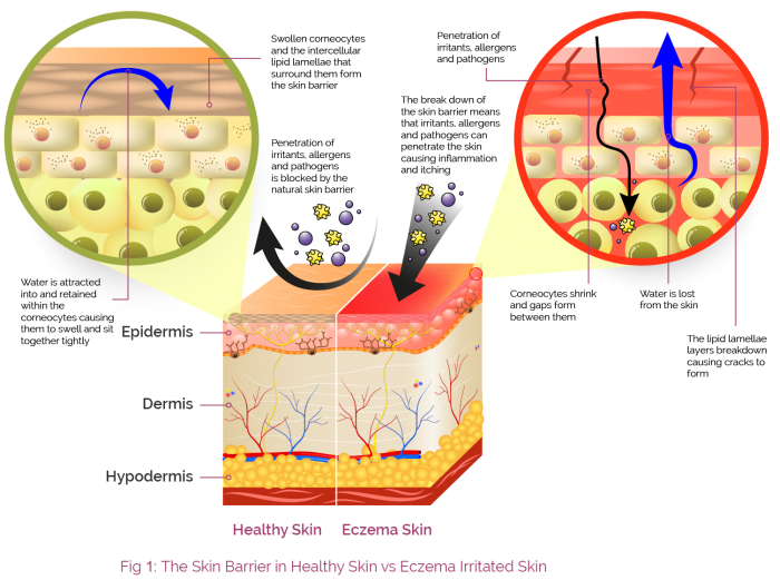 HCP_Skin Barrier | AproDerm®