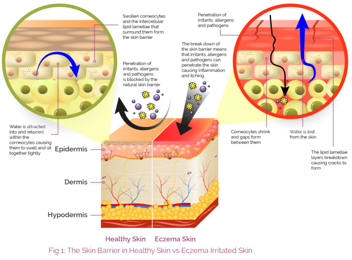 Skin_Barrier_diagram_main-1200×834 | AproDerm®