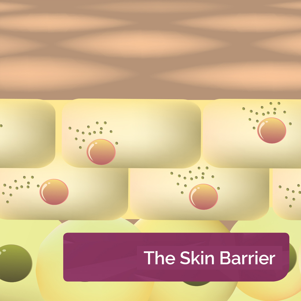 The Skin Barrier