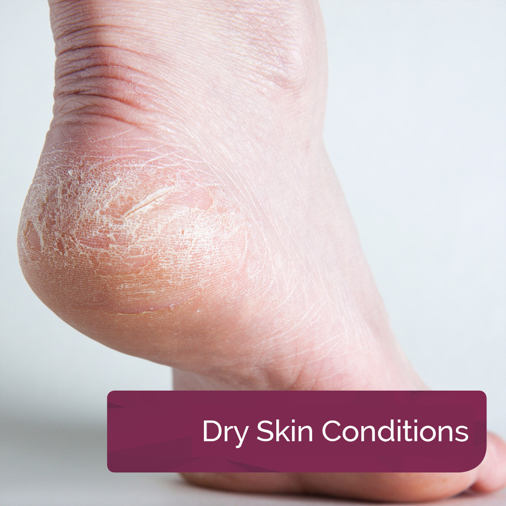 Dry Skin Conditions