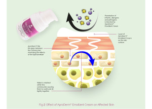 Effect of AproDerm Emollient Cream on Affected Skin