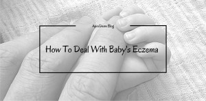How To Deal With Baby's Eczema header