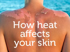 How heat can affect your skin